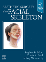 Facial Skeleton