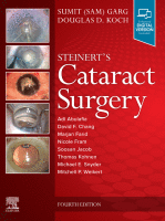 Steinert&#039;s Cataract Surgery