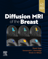 Diffusion MRI of the Breast