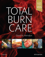 Total Burn Care