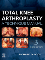 Total Knee Arthroplasty
