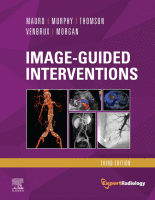 Image-Guided Interventions