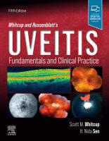 Whitcup and Nussenblatt&#039;s Uveitis