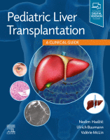 Pediatric Liver Transplantation