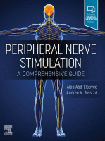Peripheral Nerve Stimulation