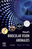Pickwell&#039;s Binocular Vision Anomalies