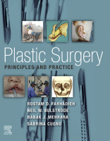 Plastic Surgery: Principles and Practice