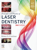 Principles and Practice of Laser Dentistry