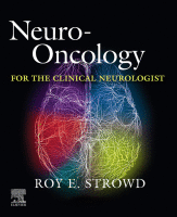 Neuro-Oncology for the Clinical Neurologist