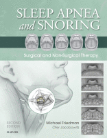 Sleep Apnea and Snoring