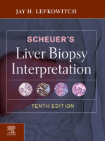 Scheuer&#039;s Liver Biopsy Interpretation