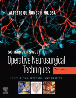 Schmidek and Sweet&#039;s Operative Neurosurgical Techniques