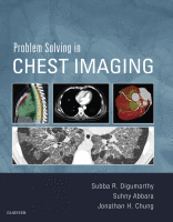 Problem Solving in Chest Imaging