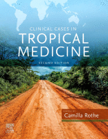 Tropical Medicine