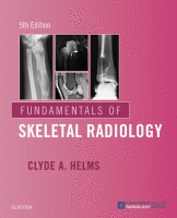 Fundamentals of Skeletal Radiology