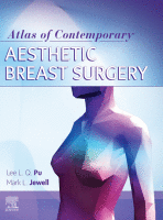 Atlas of Contemporary Aesthetic Breast Surgery