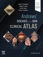 Andrews&#039; Diseases of the Skin Clinical Atlas