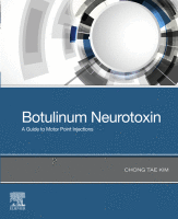 Botulinum Neurotoxin