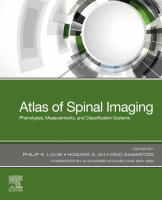 Atlas of Spinal Imaging